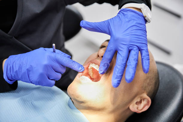 Best Emergency Gum Treatment in Mack, OH